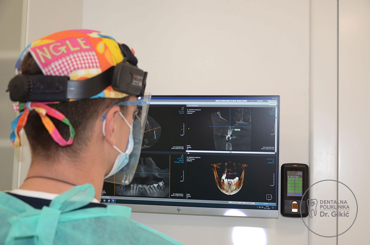 oral surgery