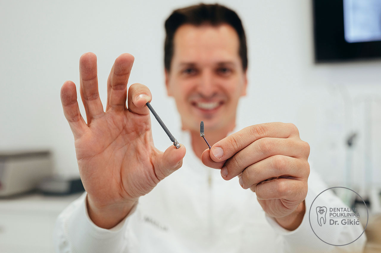 zygoma implants